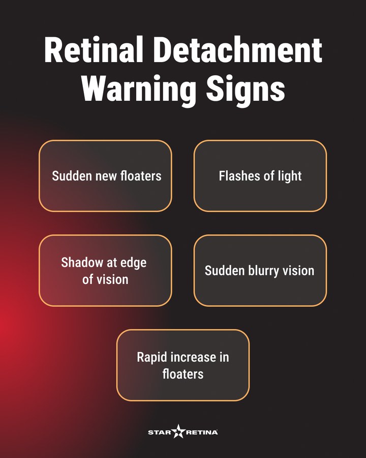 Star Retina social post