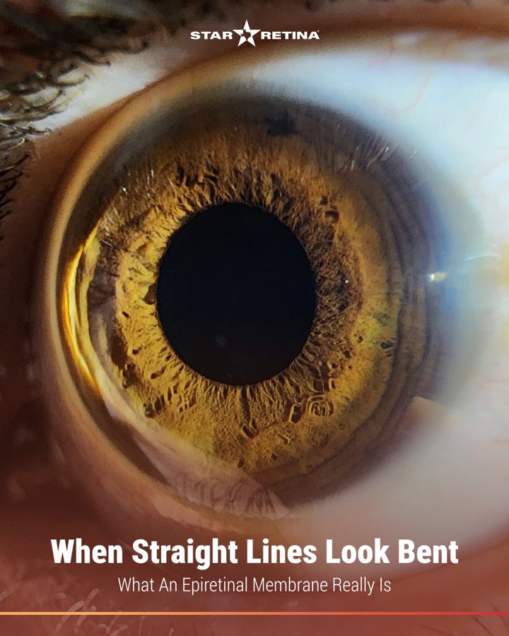 Star Retina social post